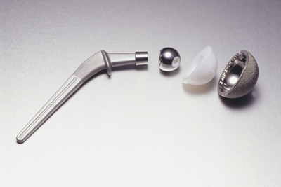 metal-on-metal hip implants