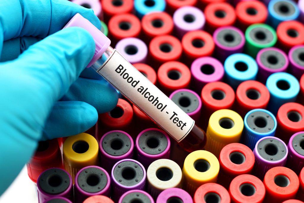 Blood sample for alcohol test